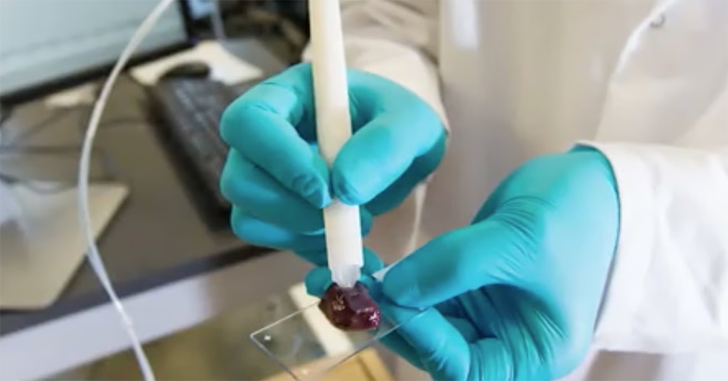 Thiết bị MasSpec Pen, còn được gọi là “bút phát hiện ung thư. Ảnh: Quazmedia.com